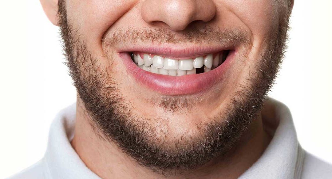 Emergency Dentist in Orange NSW: What to Do When a Tooth Breaks at 9 PM