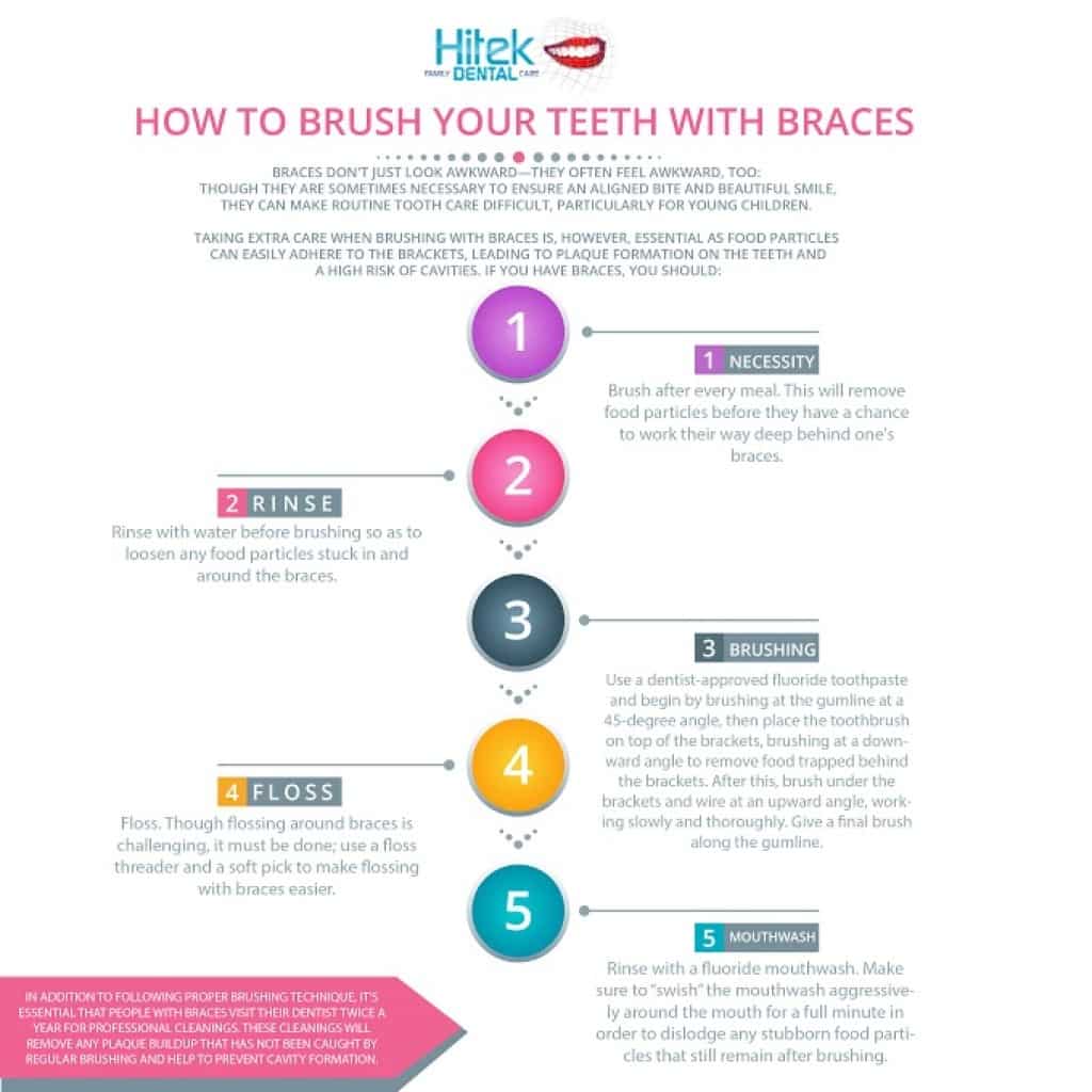 How to Brush Teeth with Braces Hitek Family Dental Blog