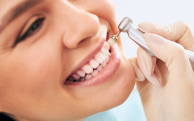 How Often Should You Visit the Dentist?