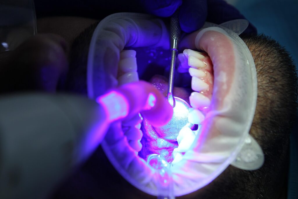 using a UV light during a tooth whitening session at the dentist office