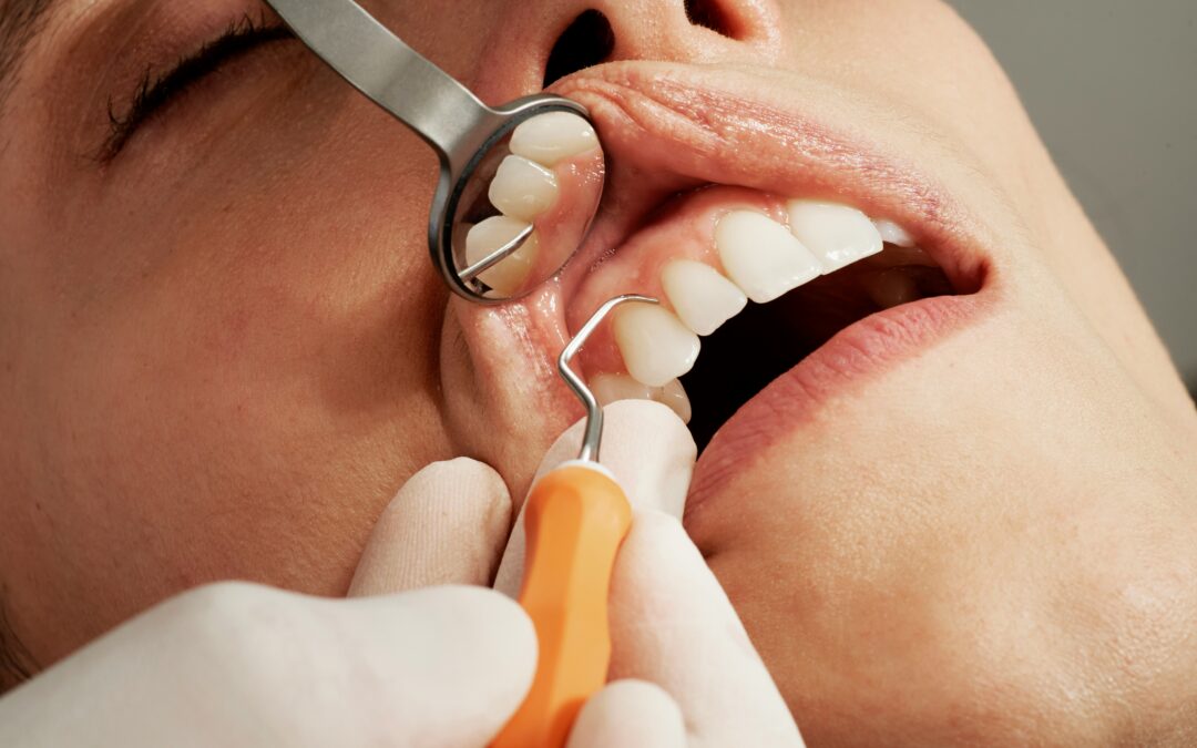 Sleep Dentistry Explained: Stress-Free Dental Work for Central West Patients