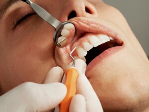 a woman's teeth being checked during a dental exam.